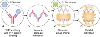 Proposed mechanism for VITT antibodies forming platelet-activating immune complexes