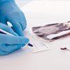 cord blood bag and label being filled out