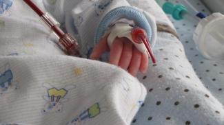 Infant hand with blood filled intravenous tube attached - the tube is almost the same size as the tiny baby's hand 