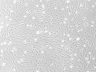 Mesenchymel stem cells, credit Dr. Saad Khan 