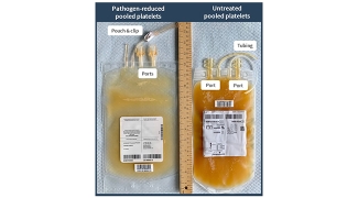 pooled Platelet bag