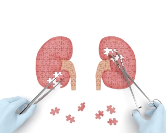 kidney matching pieces