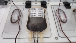 A unit of whole blood at the Blood4Research facility in Vancouver, BC.