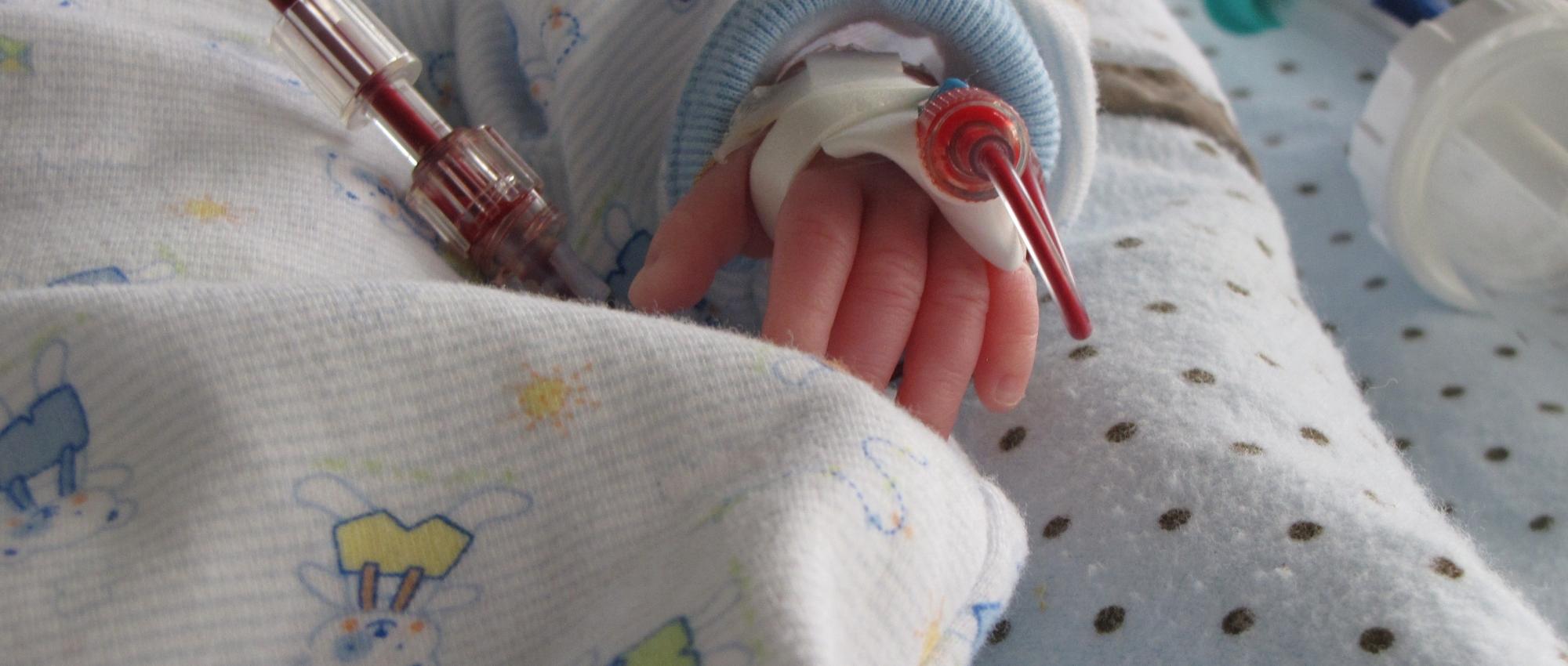 Image of a baby in the hospital bed performing a blood transfusion